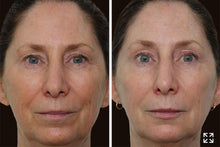Load image into Gallery viewer, AGE DEFYING MULTICOMPLEX (30ML) - RETINOL - Alexia Makeup • Hair • Beauty